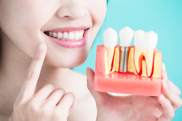 woman take tooth implant false tooth on green background